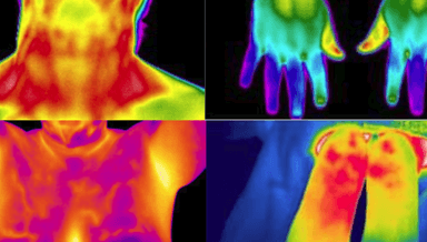 Image for Total-Body Thermography